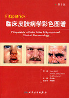 Fitzpatrick临床皮肤病学彩色图谱（第5版）邵长庚2008，彩，书签