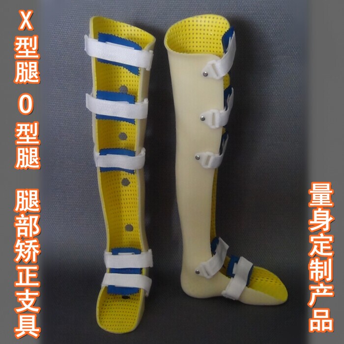 定制腿部支具 X型腿 O型腿 医用矫正支具 骨科矫形器 可调矫正